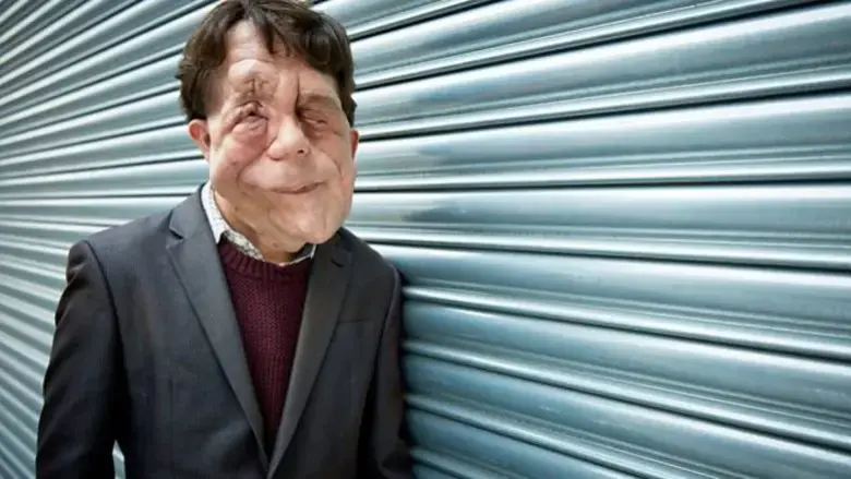 The Ugly Face of Disability Hate Crime (2015)