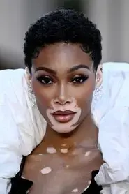 Winnie Harlow