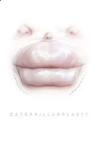 caterpillarplasty-2018