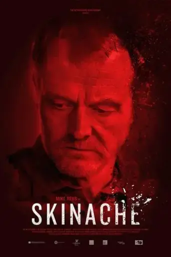 skinache-2017