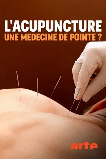 spitzenmedizin-akupunktur-mythos-oder-therapie-2020