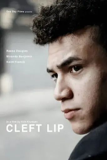 cleft-lip-2019