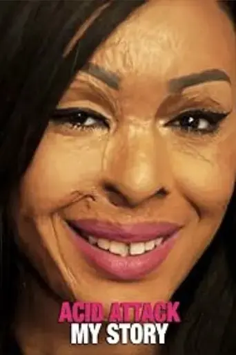 acid-attack-my-story-2018